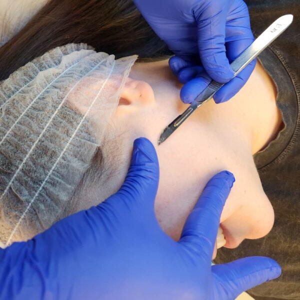 Dermaplaning vs. HydraFacial Choosing the Ideal Facial Treatment