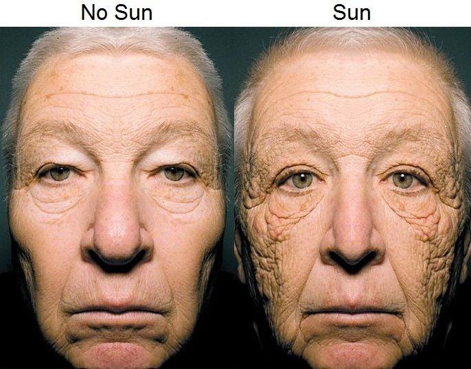 man with sun damage and without