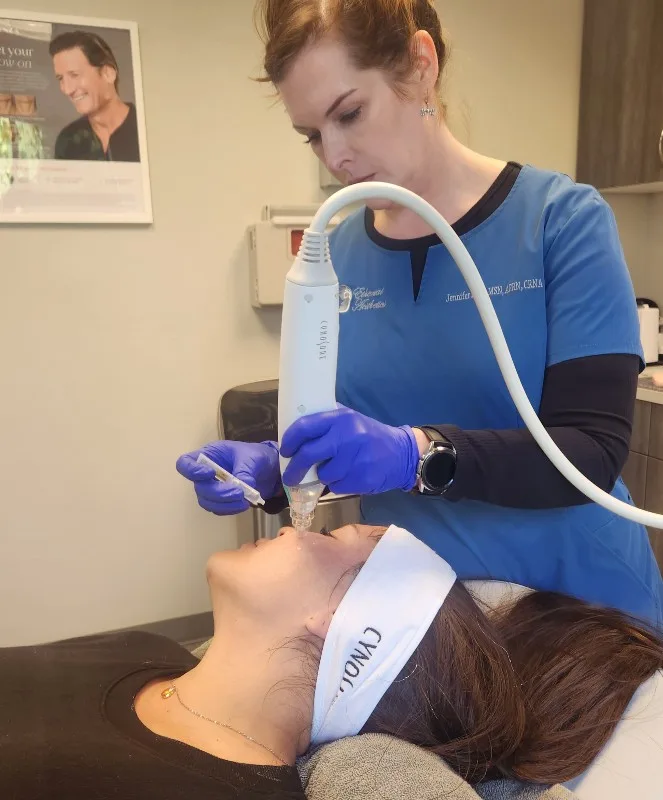 woman receiving a potenza rf microneedling treatment vancouver, wa